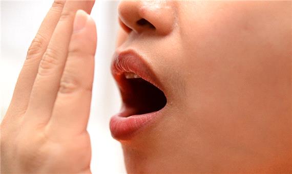 توصیه‌هایی برای کاهش بوی بد دهان در روزه‎‎داران
