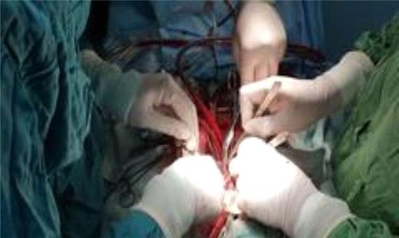 یک عمل نادر قلب در بیمارستان افشار یزد با موفقیت انجام شد